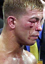 Gatti bleeds again