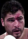 Ruiz looks beat up
